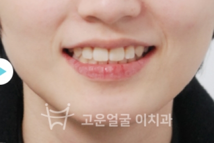 치료후기 이미지